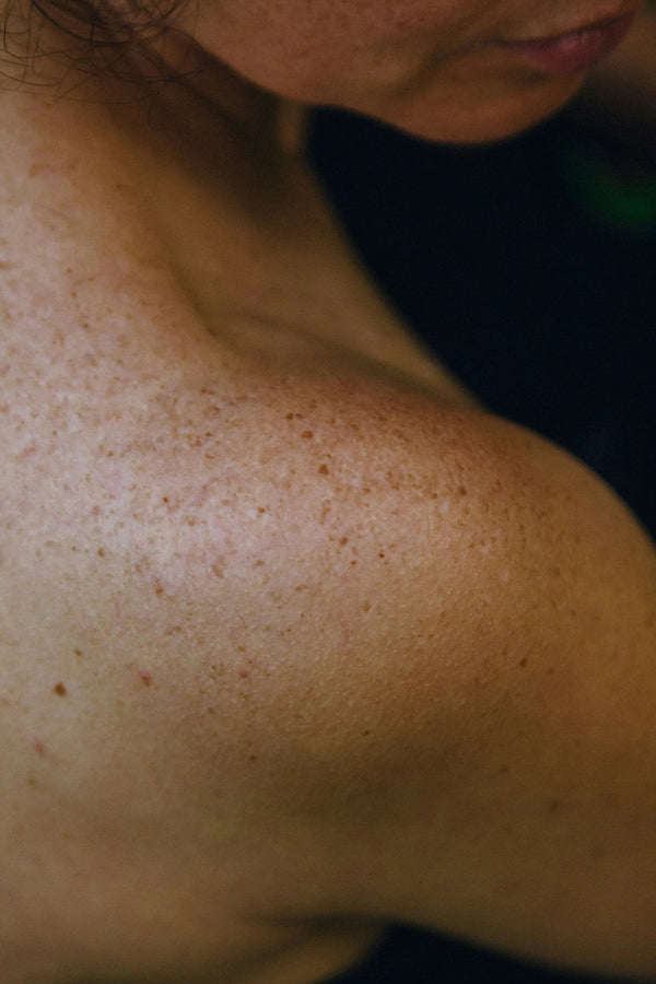 Close-up of a freckled shoulder and neck, photo by Sam Badmaeva