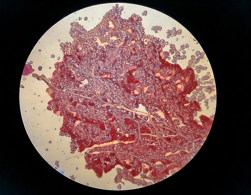 Bifidobacterium longum