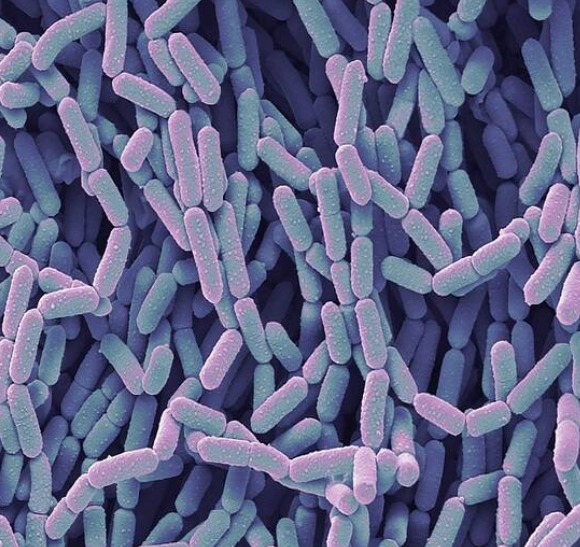 Lactobacillus casei rhamnosus
